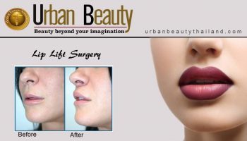 Lip Surgery Thailand