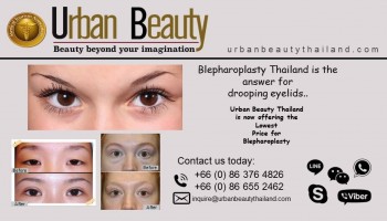 Upper Eyelid Fat Surgery in Thailand: Blepharoplasty How to Remove