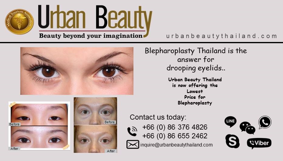 blepharoplasty thailand