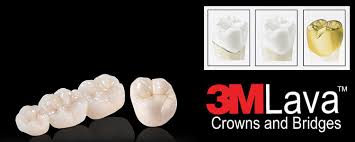 Best Price Dental Crowns Thailand