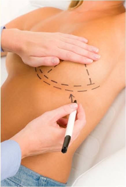 endoscopic breast augmentation Thailand