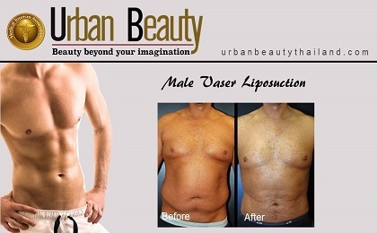 male-liposuction-bangkok-thailand