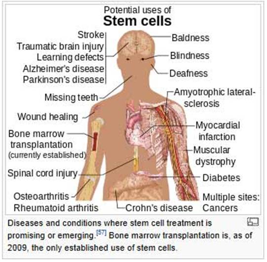 stem cell fat graft bangkok thailand bangkok