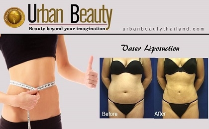 Buttock Augmentation - Urban Beauty Thailand