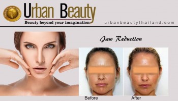 Jaw Reduction Thailand