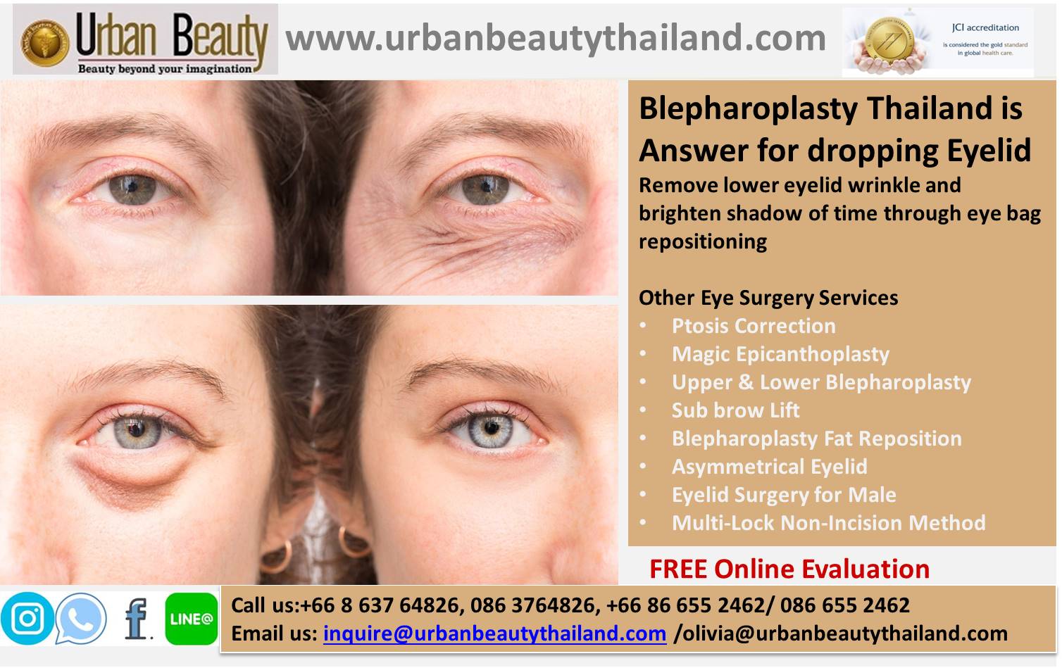 Lower Eyelid Surgery Thailand - Urban Beauty Thailand