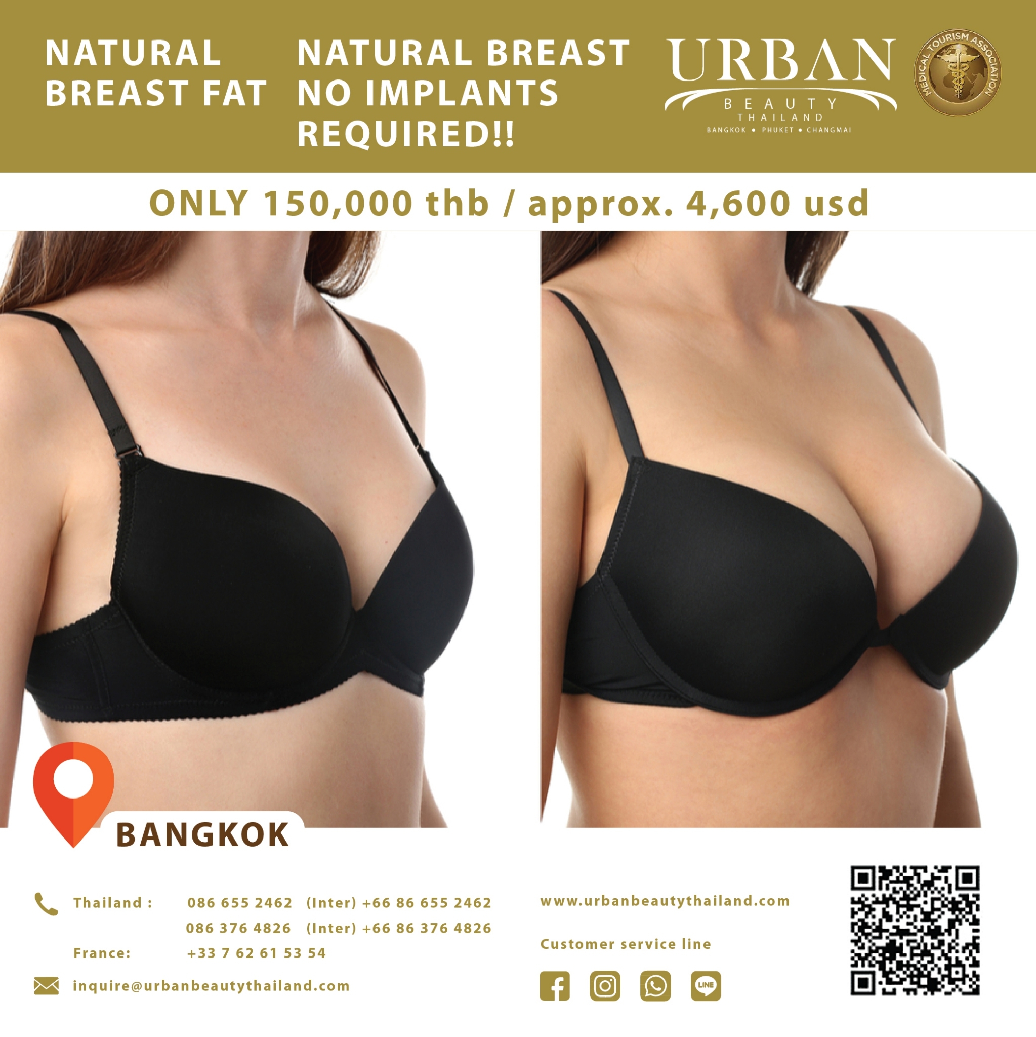 Save up to 80% Thailand Stemcell Breast augmentation - Bangkok