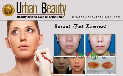 Buccal fat extraction Thailand