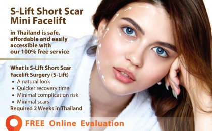 S Lift-Short Scar Mini Facelift Thailand