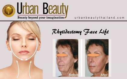 Facelift and Necklift Surgery Thailand