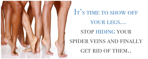 spider-vein-banner