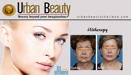 ultherapy-facelift-bangkok-thailand