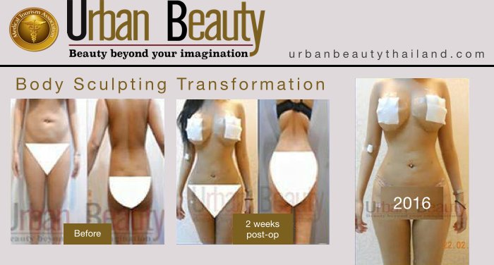 Buttock Augmentation - Urban Beauty Thailand