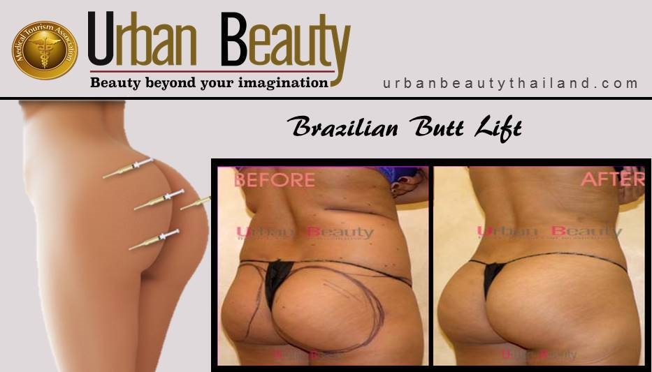 brazilian-buttlift-bangkok thailand bangkok