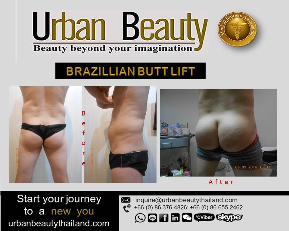 men brazilian butt lift bangkok thailand