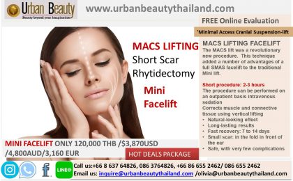 Mini Facelift, Quicklift, Weekend Facelift Thailand Cost