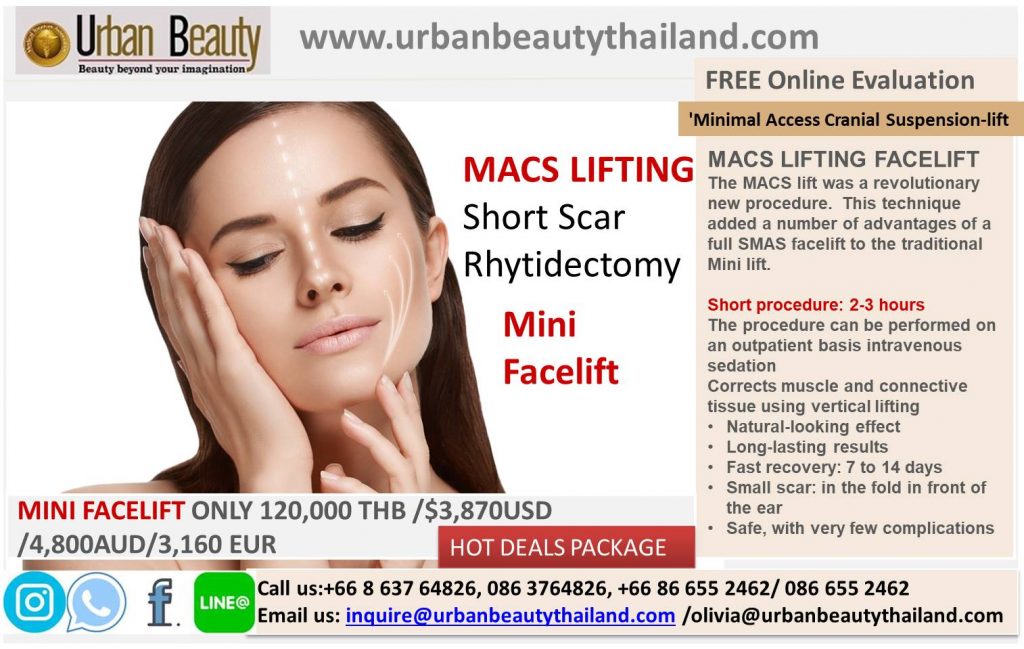 Mini Facelift, Quicklift, Weekend Facelift Thailand Cost - Urban Beauty ...