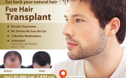 FUE Hair Loss Solutions Thailand /Grow Back Your Hair in Thailand /Hair Transplant Thailand
