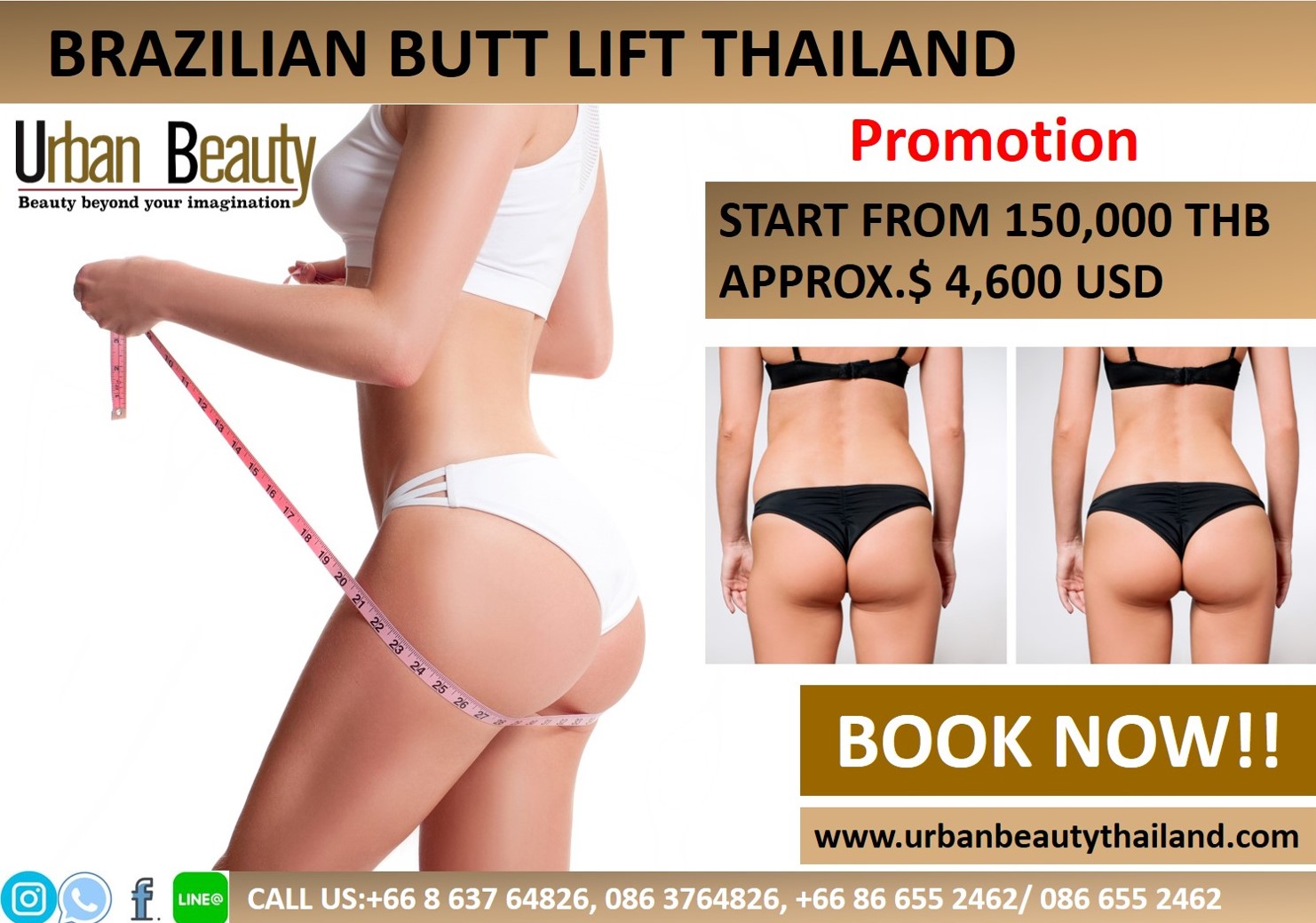 Buttock Augmentation - Urban Beauty Thailand