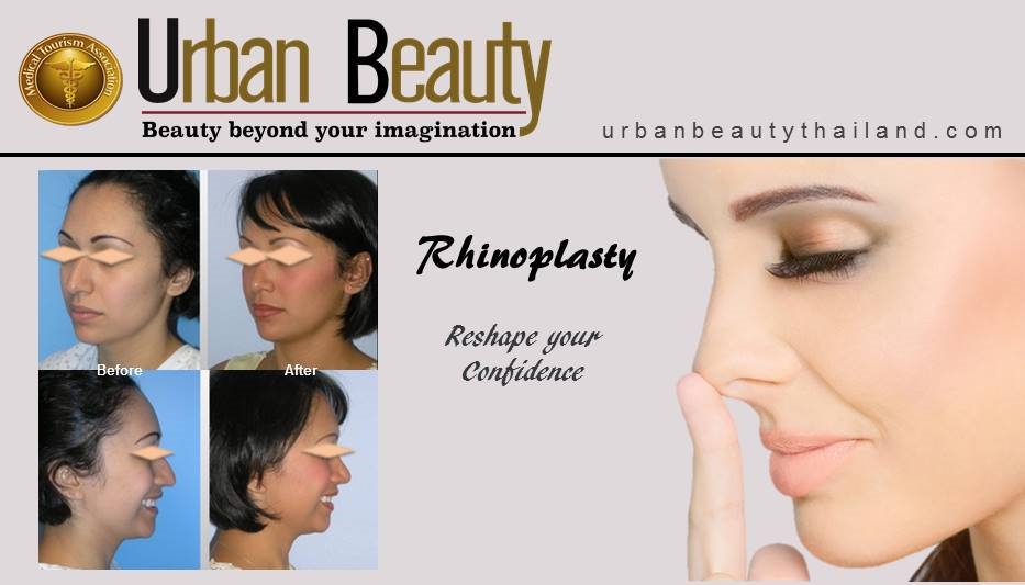 Rhinoplasty thailand