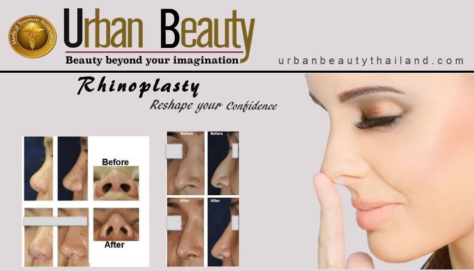 Rhinoplasty_bangkok thailand