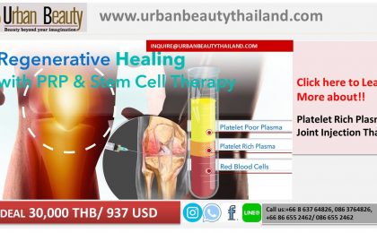 Stem Cell Joint  Repair Treatment Osteoarthritis Cartilage in Bangkok, Thailand