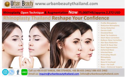 Rhinoplasty Correction, Nose Reshaping, Nose Job in Thailand at Cost Effective