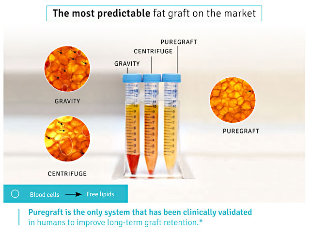 blood-cells-fat-graft-bangkok-thailand