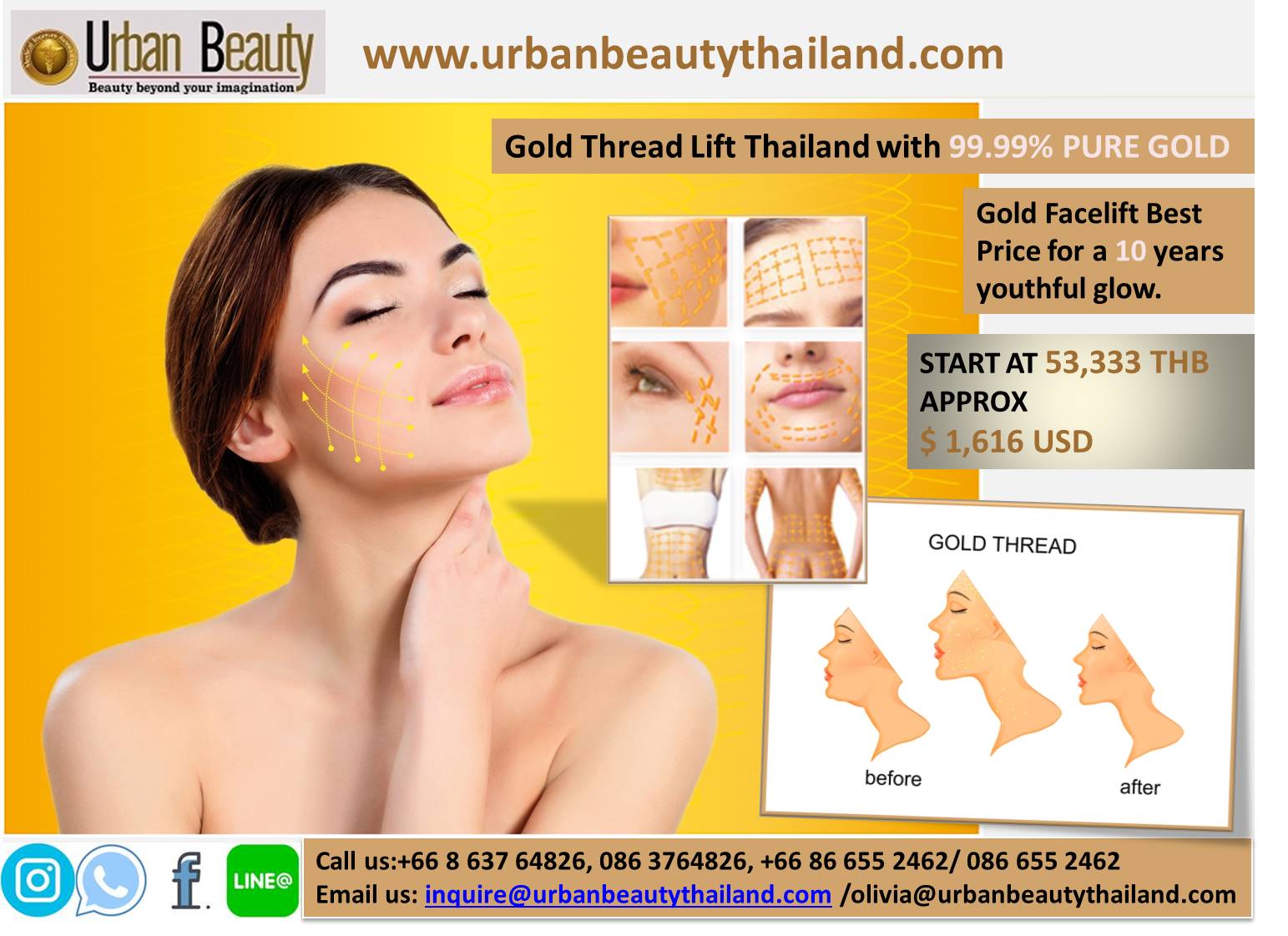 Gold Thread Lift- Face Lift Thailand
