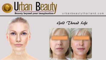 Gold Thread Facelift with Stem Cell Facelift Bangkok, Thailand