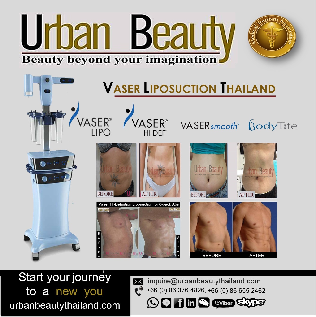 vaser Liposuction vaser Hi def bangkok thailand