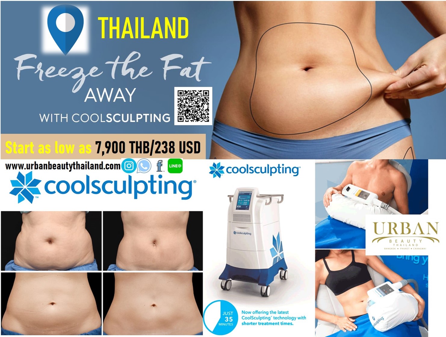 Lowest Price Coolsculpting Bangkok, Phuket Thailand Fat Removal