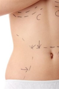 fat-transfer-bangkok thailand liposuction