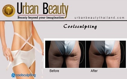 coolsculpting-fat-removal-bangkok-thailand