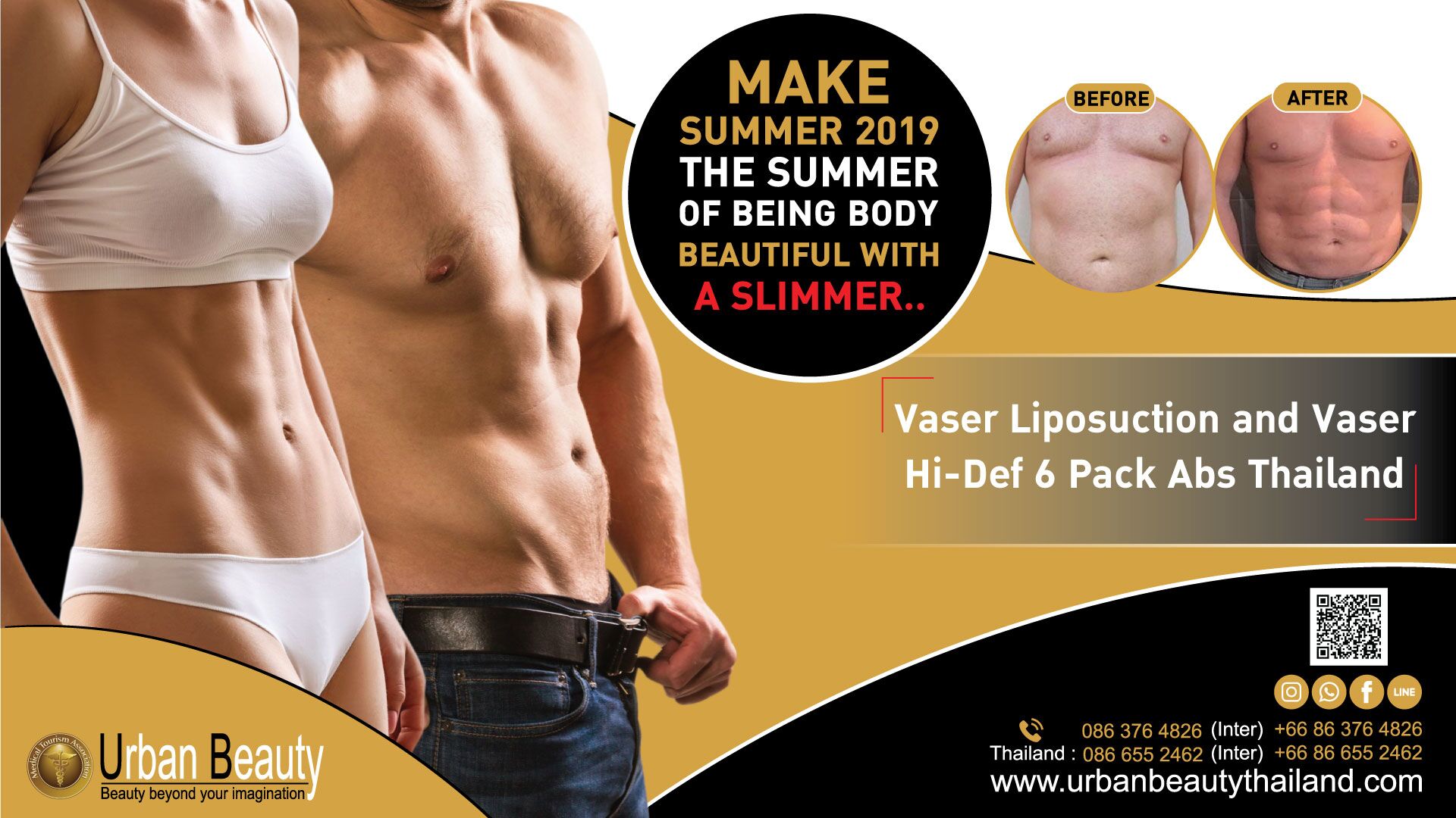 Low Cost Liposuction Bangkok Cosmetic Surgery, Vaser Liposuction