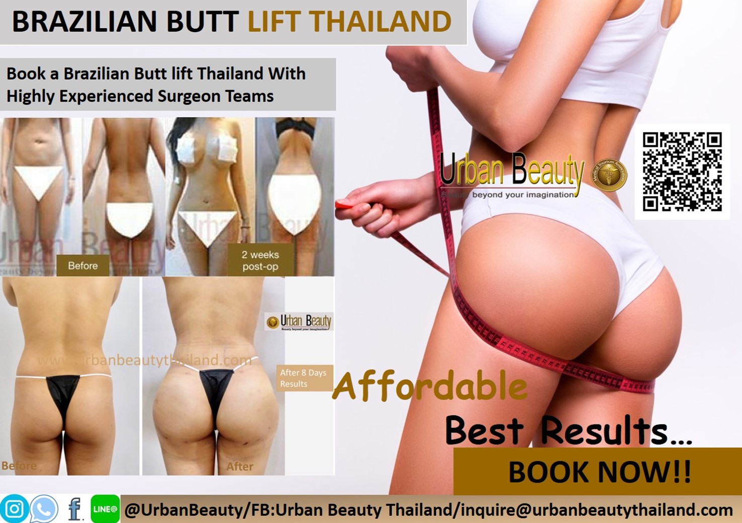 Buttock Augmentation - Urban Beauty Thailand