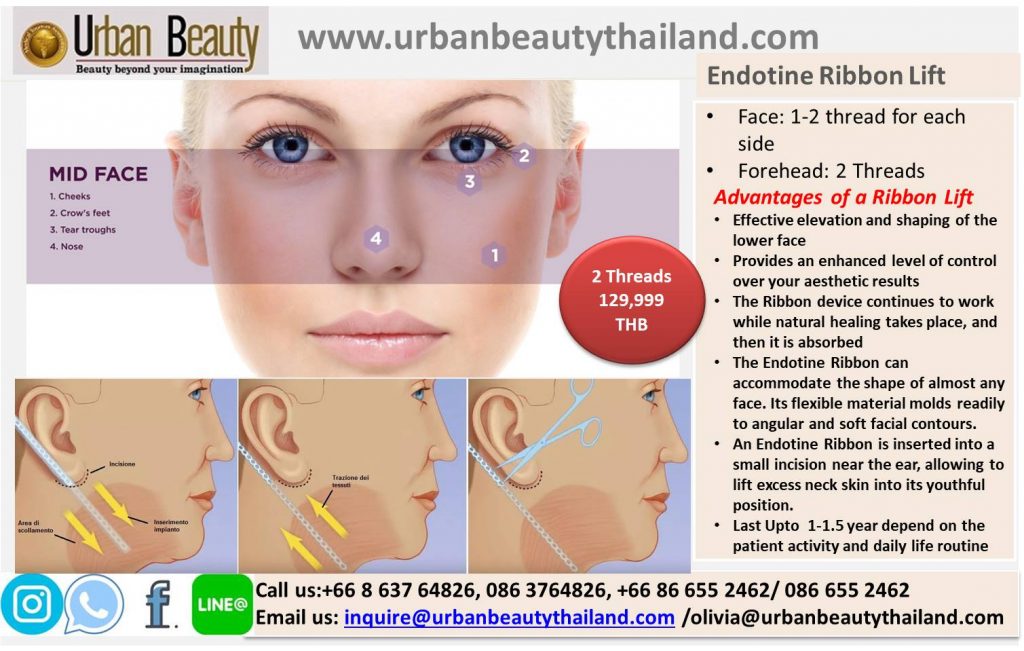 Revolutionary Endotine Ribbon Lift Facelift Thailand - Urban Beauty ...