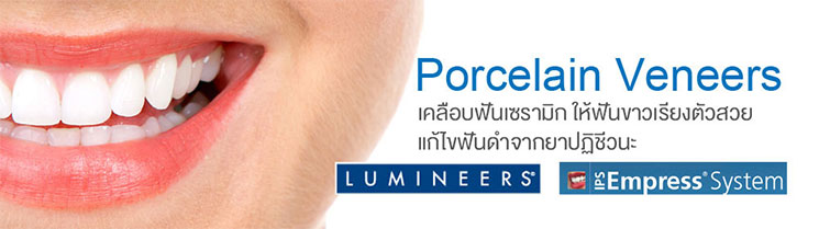 porcelain-veneers-thailand-jpg