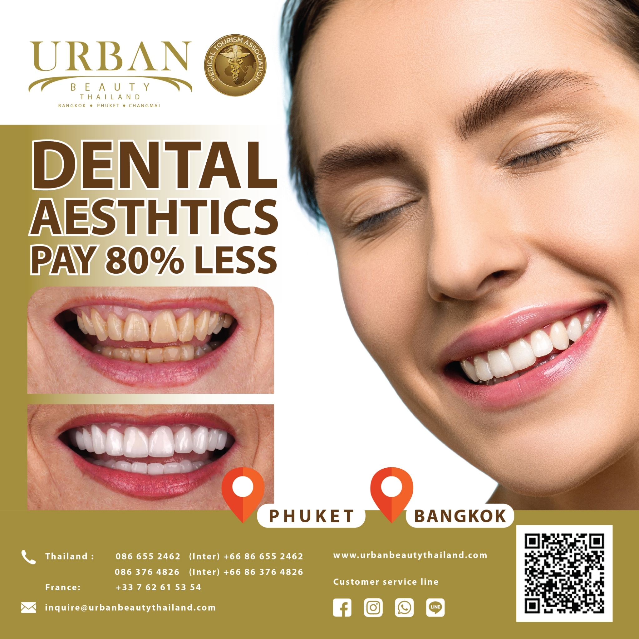 Dental Blog Treatments  Bangkok Dental, Dentist by Bangkok Smile