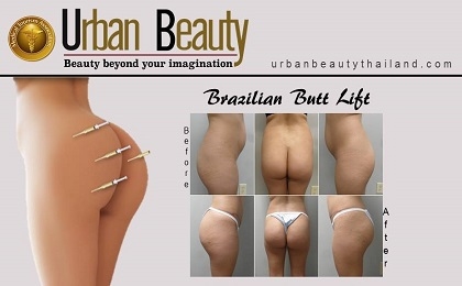 brazilian-butt-lift-bangkok-thailand-bangkok