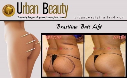 brazilian-butt-lift-bangkok-thailand