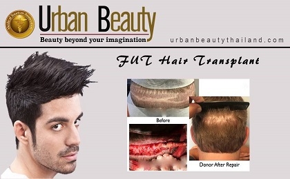 fut-hair-transplant-bangkok-thailand-bangkok