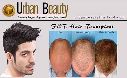 fut-hair-transplant-bangkok-thailand
