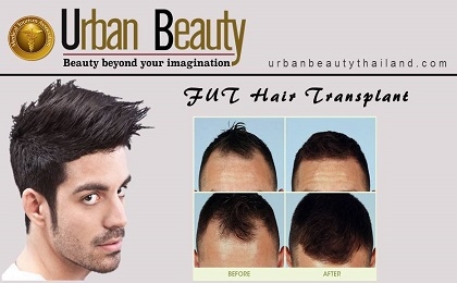 fut-hair-transplant-thailand