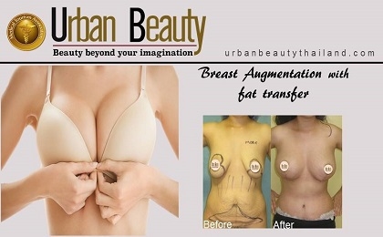 Fat transfer bra PI filling 