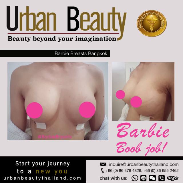 breast-augmentation-bangkok
