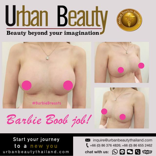 breast-implants-bangkok-thailand