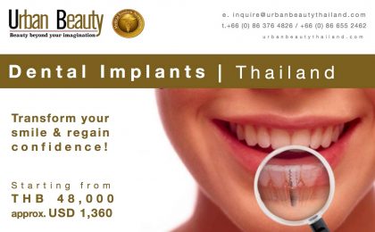 Dental Implant Thailand, Dental Implants Bangkok – Transform your smile from just THB 48,000, approx. USD 1,360