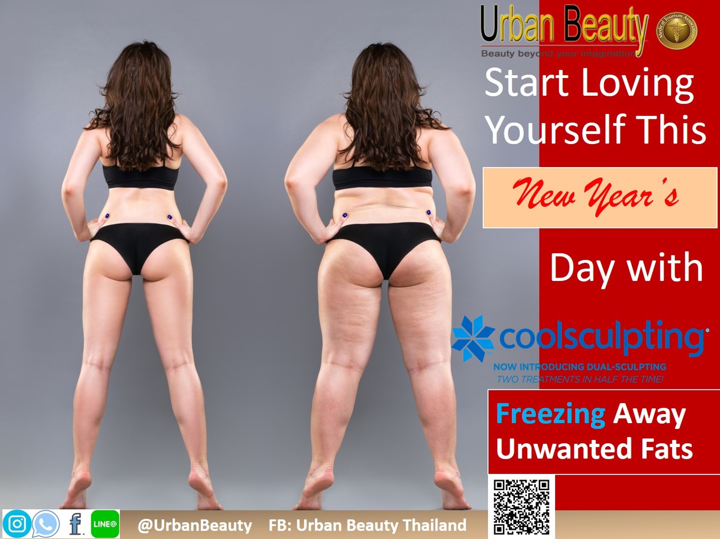 Lowest Cost CoolSculpting, Zeltiq, Freezing Fat Thailand - Urban Beauty  Thailand