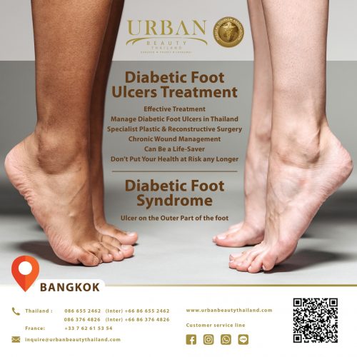 Diabetic? You Can't Ignore Foot Ulcers! — North Fork Podiatry | Three  Village Podiatry